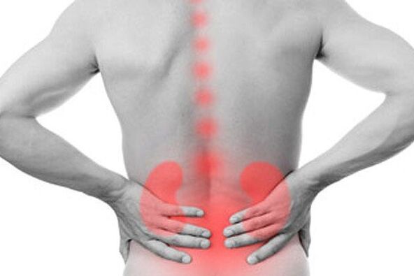 Kidney pathologies can cause the onset of low back pain