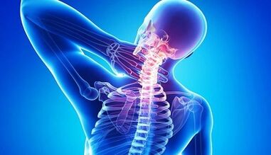 Symptoms and treatment of cervical osteochondosis