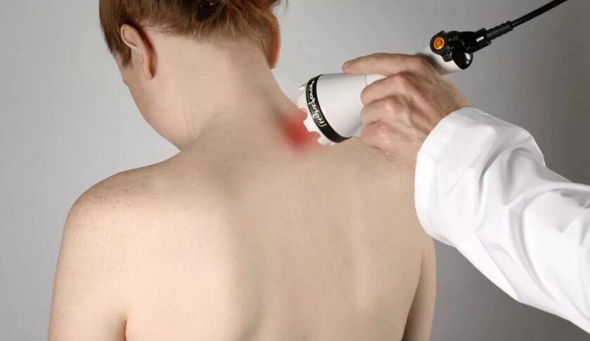 Physiotherapeutic method to treat cervical osteochondrosis