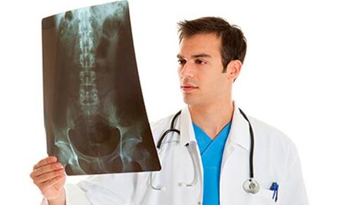 doctor looking at an x-ray to diagnose lower back pain